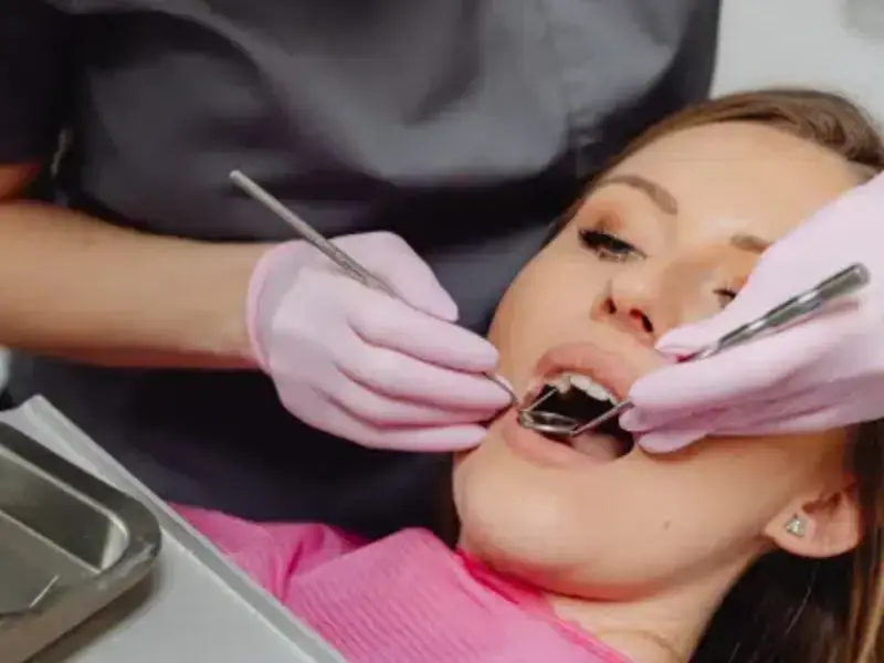 Dental Fillings Smile Center Islamabad 1