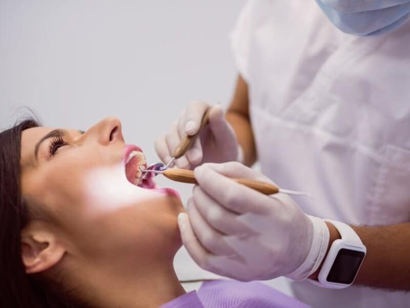 Teeth Whitening Smile Center Islamabad 1